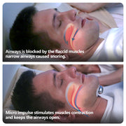 Smart Anti-Snoring Muscle Stimulator